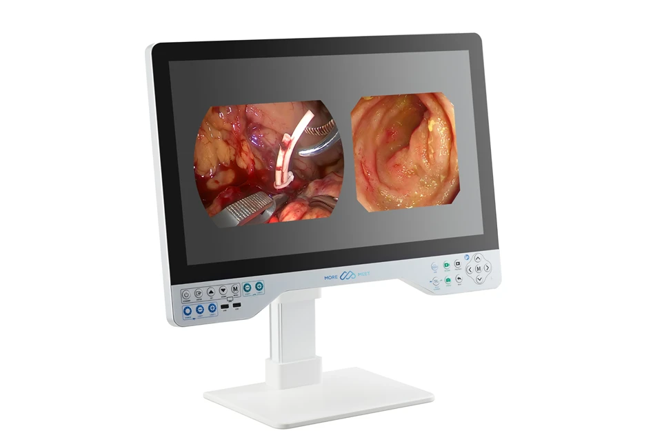 Rigid-Flex Endoscope