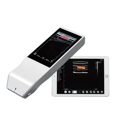 Màquina d’ultrasons sense fils portàtil FTL-V5L