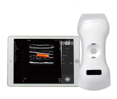 Mini màquina d’ecografia de mà